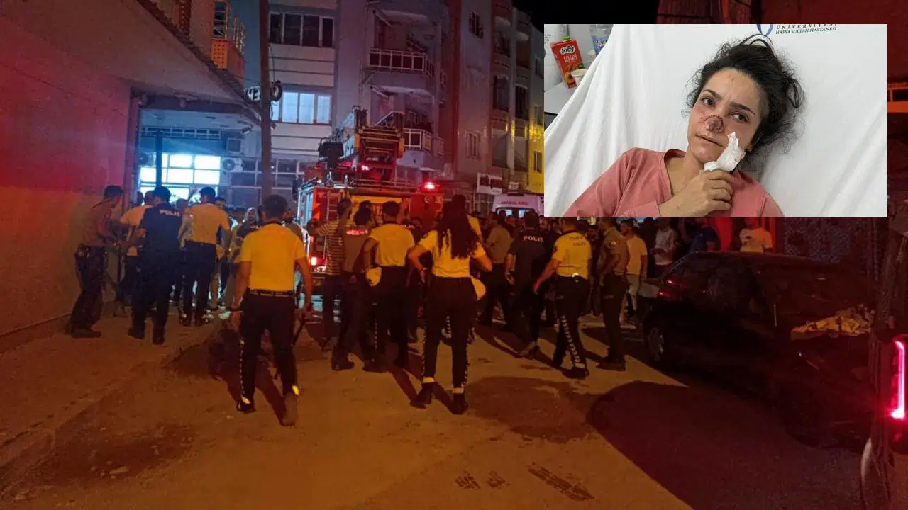 Manisada akilalmaz dehset evli oldugu kadinin burnunu isirip kopardi d7TxzGa3